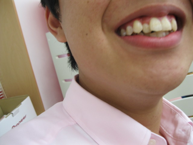 中古車販売 中古車買取 アップル